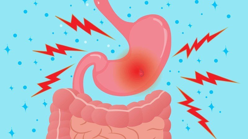 Rối loạn tiêu hóa